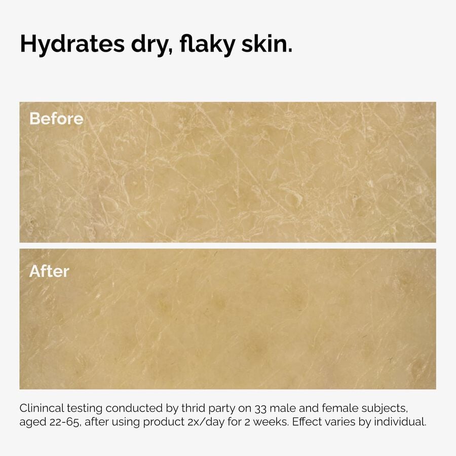 the-body-care-collection-k7 ord-natural-moisturizing-factors-inulin-body-before-after-graphic-02.jpg
