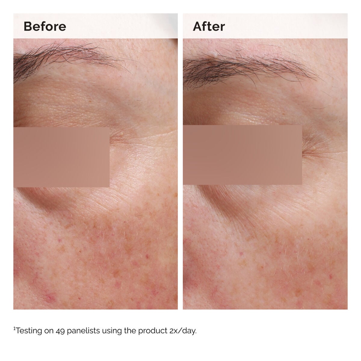 niacinamide-5-face-and-body-emulsion-d9 2024-08-23-ORD-Nia-5pct-Face-Body-B-A-Elasticity-Global-02-1x1.jpg