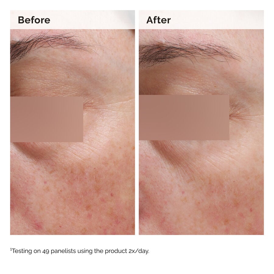 niacinamide-5-face-and-body-emulsion-d9 2024-08-23-ORD-Nia-5pct-Face-Body-B-A-Elasticity-Global-02-1x1.jpg