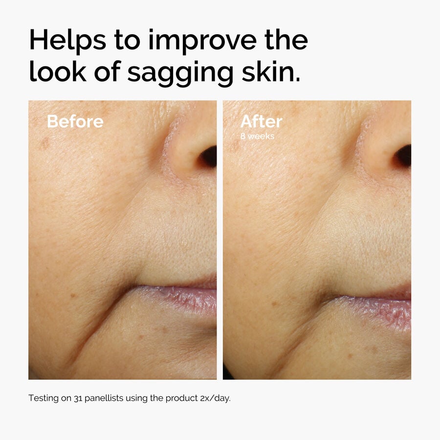 caffeine-3-escin-1-face-serum-m9 ord-caffeine-3pct-escin-1pct-face-serum-before-after-sagging.jpg