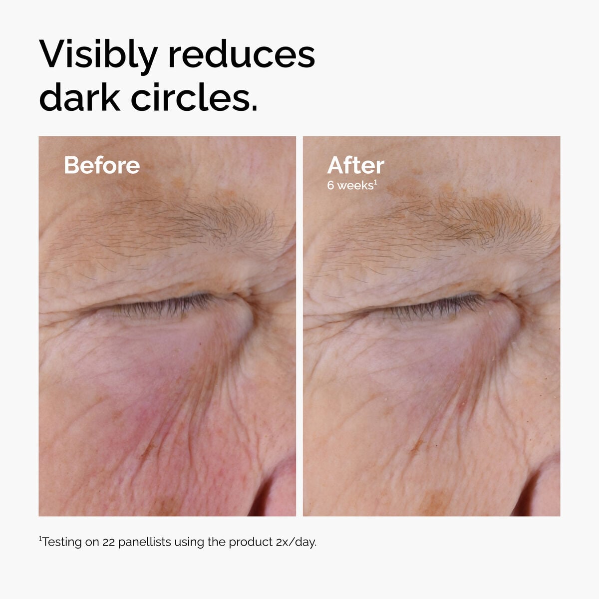 caffeine-solution-5-egcg-eye-serum-e9 ord-caffeine-solution-egcg-dark-circles-before-after.jpg