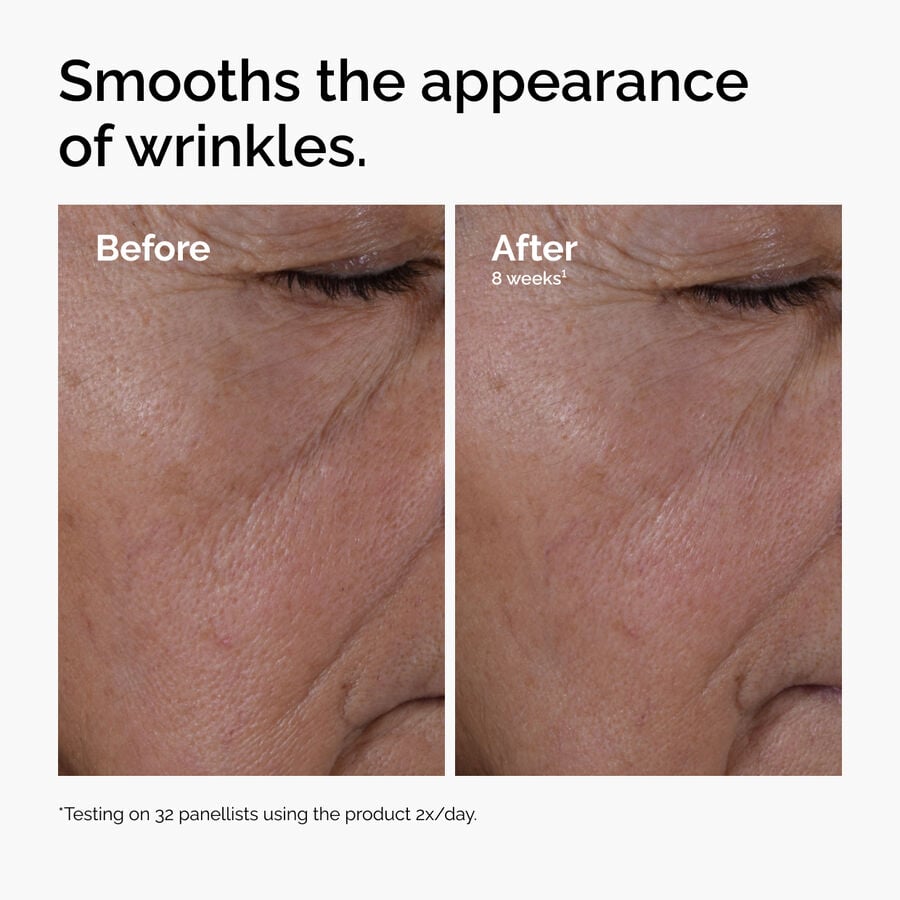 multi-peptide-ha-serum-i2 ord-multi-peptide-ha-serum-wrinkles-before-after.jpg