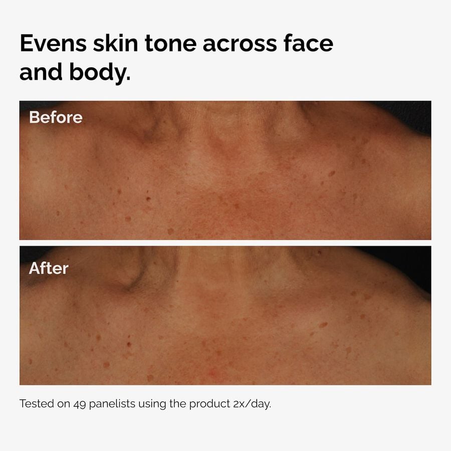 the-body-care-collection-k7 ord-niacinamide-face-body-serum-before-after-even-tone-graphic.jpg