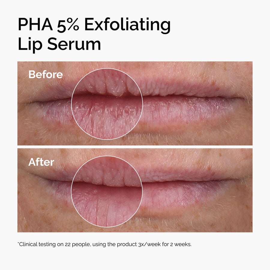 pha-5-exfoliating-lip-serum-n1 ord-pha-5pct-lip-exfoliating-serum-before-after.jpg