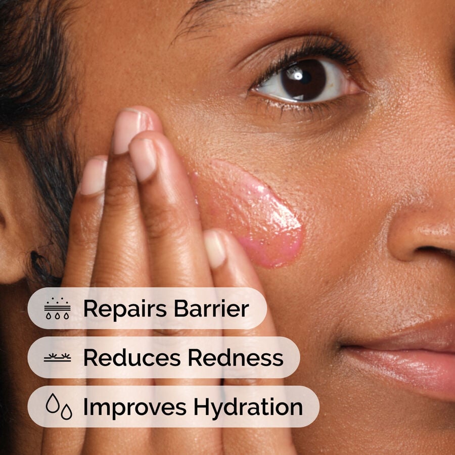 soothing-and-barrier-support-serum-set-o0 ord-soothing-barrier-support-serum-model-application-with-benefits.jpg